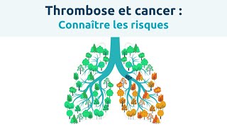 Thrombose et cancer Vidéo Patients  Connaître les risques [upl. by Delamare]