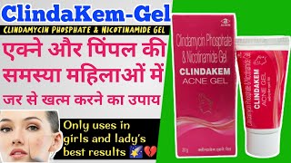 Clindakem Acne Gel  What Is Uses And Benefits All About In Hindi [upl. by Anec]