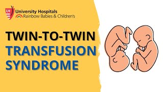 Twin to Twin Transfusion Syndrome [upl. by Rubenstein]