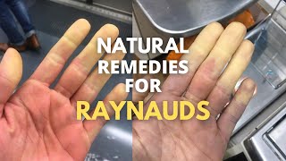 5 natural remedies for RAYNAUDS [upl. by Leach]