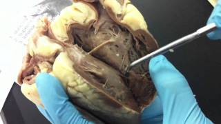 Sheep heart dissection [upl. by Mirella]