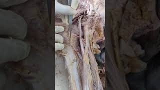 cruciate anastomosis and charcoat anastomosis [upl. by Sivet197]