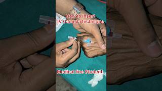 IV Cannula technique IV Cannula कैसे लगाते हैं medical nursingh bscnurcing cannula vigo bams [upl. by Magnien]