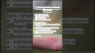 Chronic spontaneous urticaria [upl. by Tacita]