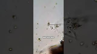 Amebas tentam se juntar e formar uma MEGA AMEBA microorganismos microbiologia curiosidades [upl. by Nivrem]