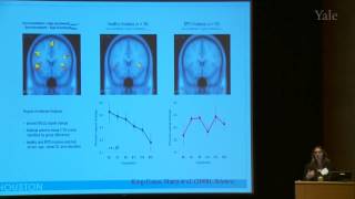 11th Annual Yale NEABPD Conference Mentalization in Borderline Personality Disorder [upl. by Dud108]