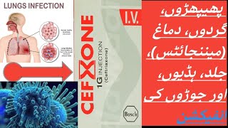 CEFXONE  CEFTRIAXONE cefxone 1g injection [upl. by Arraes47]