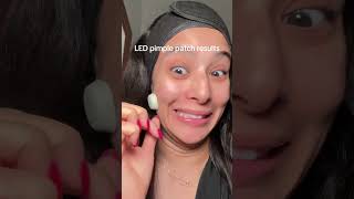 LED pimple patch removal [upl. by Jerrylee]