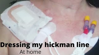 dressing a hickman line at home  broviac central line  ports lines amp PICCs [upl. by Mcallister550]