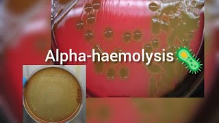 αhaemolysis streptococcus bacteria microbiology [upl. by Stephannie]