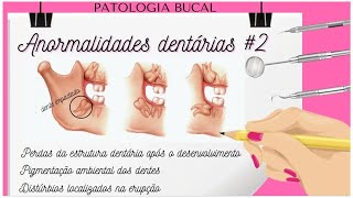 Anormalidades Dentárias  PARTE 2 [upl. by Yellac]