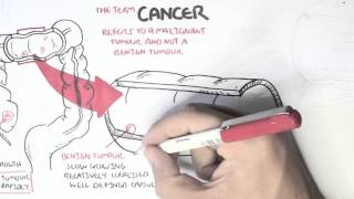 Cancer  Introduction I [upl. by Burleigh]