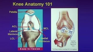 Common Traumatic Knee Injuries Oh My Aching Knee [upl. by Downs]