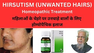 Unwanted Hairs Hirsutismअनचाहे बाल Homeopathic treatment  Natural Healing [upl. by Monro]