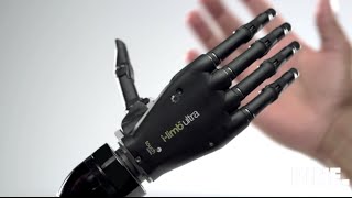 Top 5 bionic arm [upl. by Zed]