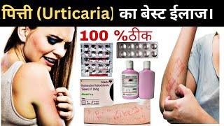 5 मिनट में पित्ती ठीक  पित्ती Urticaria का बेस्ट ईलाज  पित्ती की दवा pharmasangyan [upl. by Mera]