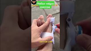 Hallux valgus exercise  Hallux valgus medical solution sorts amry sscgd ssccpo [upl. by Groscr]