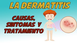 LA DERMATITIS Causas signos y síntomas diagnóstico y tratamiento [upl. by Vyky608]