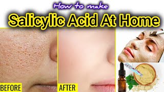 What Is Salicylic Acid amp How To Use  Homemade Salicylic Acid Face MaskRemove BlackheadsDark Spots [upl. by Wrand]