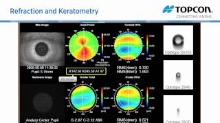 Topcon KR 1W wavefront amp topography system [upl. by Casar]