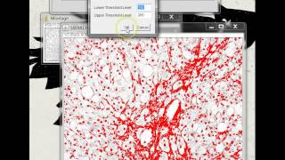 Quantifying Stained Liver Tissue Area Using ImageJ [upl. by Grenier]