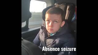 absence seizurepetit mal seizure [upl. by Ettenej490]