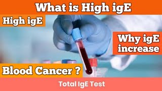 IgE  high ige levels in blood  ige level high treatment  high ige  how to cure ige allergy  ige [upl. by Elletse728]