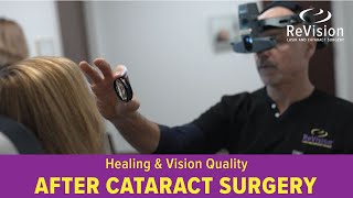 Recovery amp Vision Expectations After Cataract Surgery [upl. by Notrub]