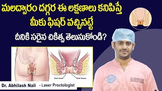 How to Diagnose Anal Fissure  Symptoms and Treatment of Fissure in Telugu  Dr Abhilash Nali [upl. by Ennasirk]