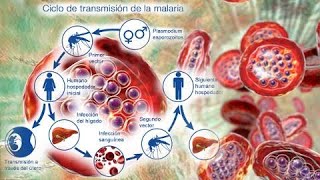 En qué consiste La Malaria y cómo tratarla  Plan Médico [upl. by Ennirak]