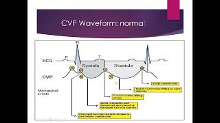 Haemodynamic Monitoring part II [upl. by Ahsienet]