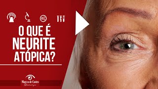 O que é a Neurite Óptica  Dr Marcos de Castro Oftalmologia [upl. by Lipsey]