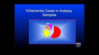 Understanding Behavioral Challenges in Lewy Body Dementia [upl. by Auberon796]