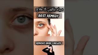 How To Remove Dark Circles Naturally At Home  Dark Circles Kaise Hataye  Dark Circles Ka Ilaj [upl. by Neelya921]