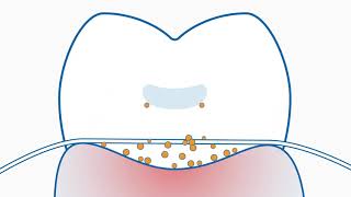 Curaprox Interdental Brushes vs Floss [upl. by Ihcehcu]