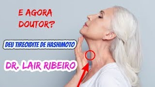 E AGORA DOUTOR LAIR RIBEIRO DEU TIREOIDITE DE HASHIMOTO TEM TRATAMENTO TIREOIDE [upl. by Lrem]