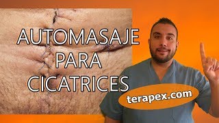 MASAJE PARA CICATRICES [upl. by Kathie]