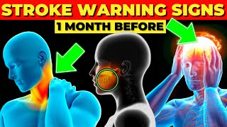 7 Stroke Symptoms 1 month before it happens Detect it Quickly [upl. by Goulette]