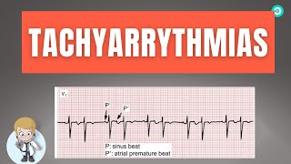 How to dignose Abnormal heart rhythm Tachyarrythmias On ECG  Step by step [upl. by Agosto]