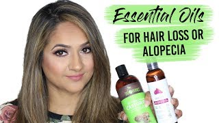 Essential Oils for Hair Loss and Alopecia [upl. by Eskil171]