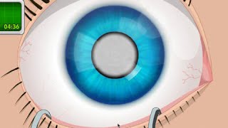 OPERATE NOW  EYE SURGERY  PLAY EYE SURGERY GAME ONLINE [upl. by Rue134]