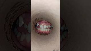 What Your SMILE Reveals About Your Oral Health 😃🦷 [upl. by Eilujna]