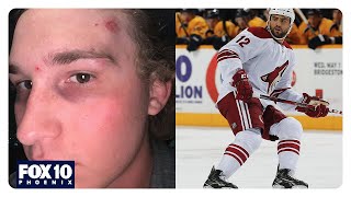 Assault victim says suspect also attacked Paul Bissonnette [upl. by Ahael]