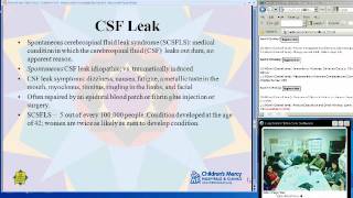 CSF Leak Rhinorrhea Sean Stanga MD [upl. by Swor487]