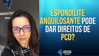 Espondilite Anquilosante dá direitos de PCD  Entenda as possibilidades [upl. by Eshman913]