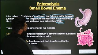 Small Bowel Enema  Enteroclysis Procedure  Part1  In Hindi  Radiological Procedure [upl. by Enihpad]