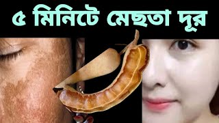 মাএ৫মিনিটে মেছতার দাগ থেকে চিরতরে মুক্তিঘরোয়া উপায়ে মেছতার দাগ দূরমেছতামেছতা দূর হবে তেতুল দিয়ে [upl. by Naamann]