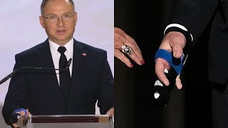 Andrzej Duda kontuzjowany Co na to lekarz quotNie był to mały urazquot [upl. by Zashin525]