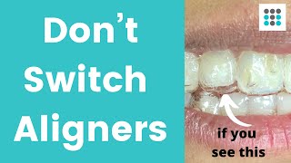 DON’T SWITCH ALIGNERS IF YOUR TEETH ARE NOT TRACKING l Dr Melissa Bailey Orthodontist [upl. by Akirdnuhs]