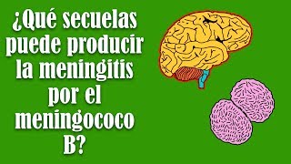 ¿Qué secuelas puede producir la meningitis por el meningococo B [upl. by Eiggam]